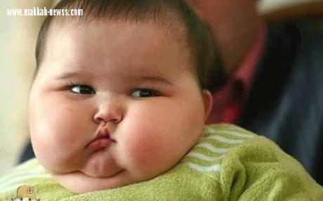 السمنة تتفوق على التدخين في التسبب بأمراض السرطان