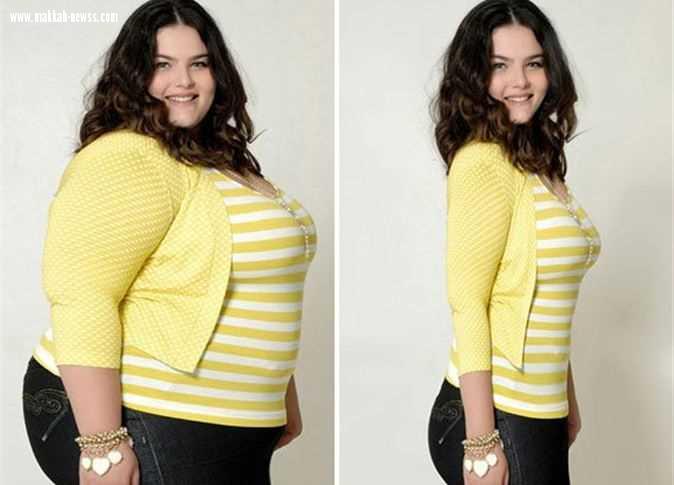 السمنة تتفوق على التدخين في التسبب بأمراض السرطان